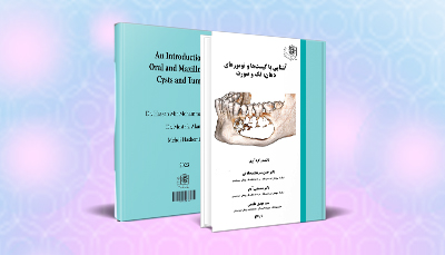 آشنایی با کیست ها و تومورهای دهان، فک و صورت
